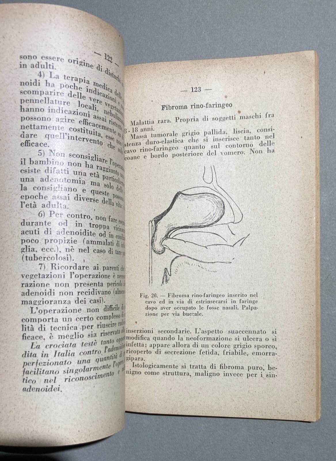Medicina: Otorinolaringoiatria (naso, Faringe, Laringe, Otiti, Faringiti). Sanvenero Rosselli, 1930