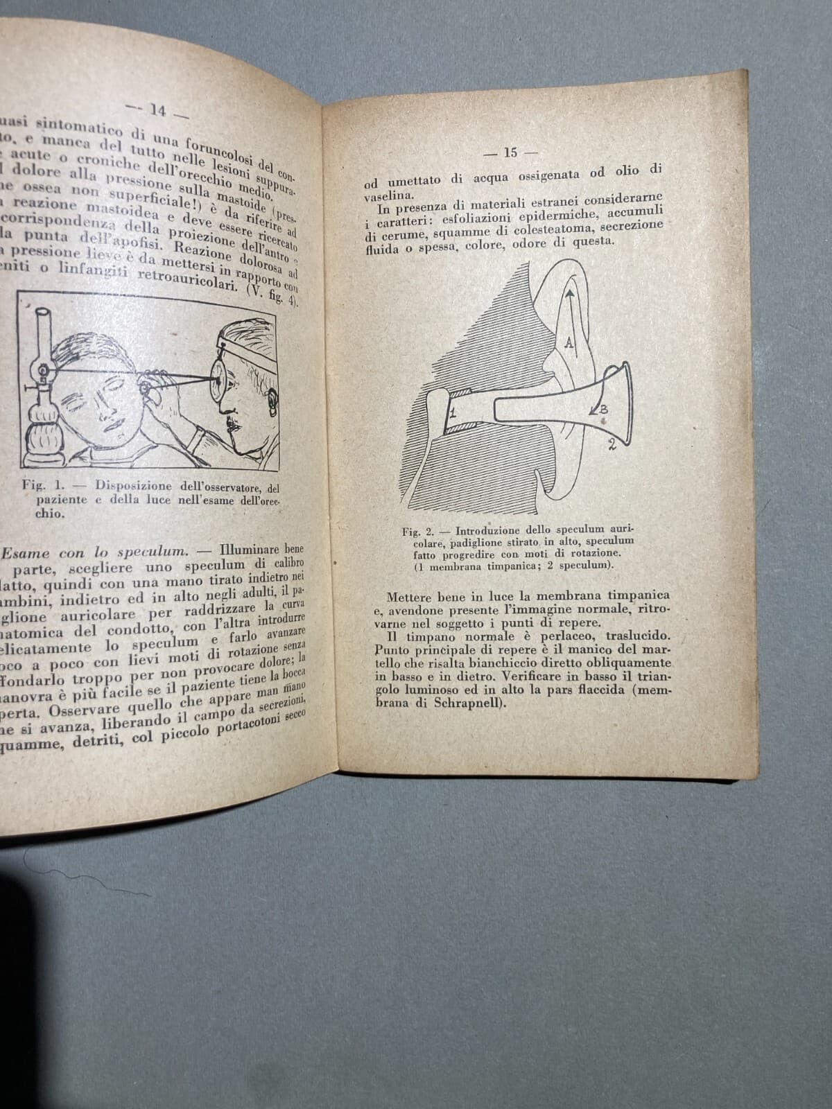 Medicina: Otorinolaringoiatria (naso, Faringe, Laringe, Otiti, Faringiti). Sanvenero Rosselli, 1930