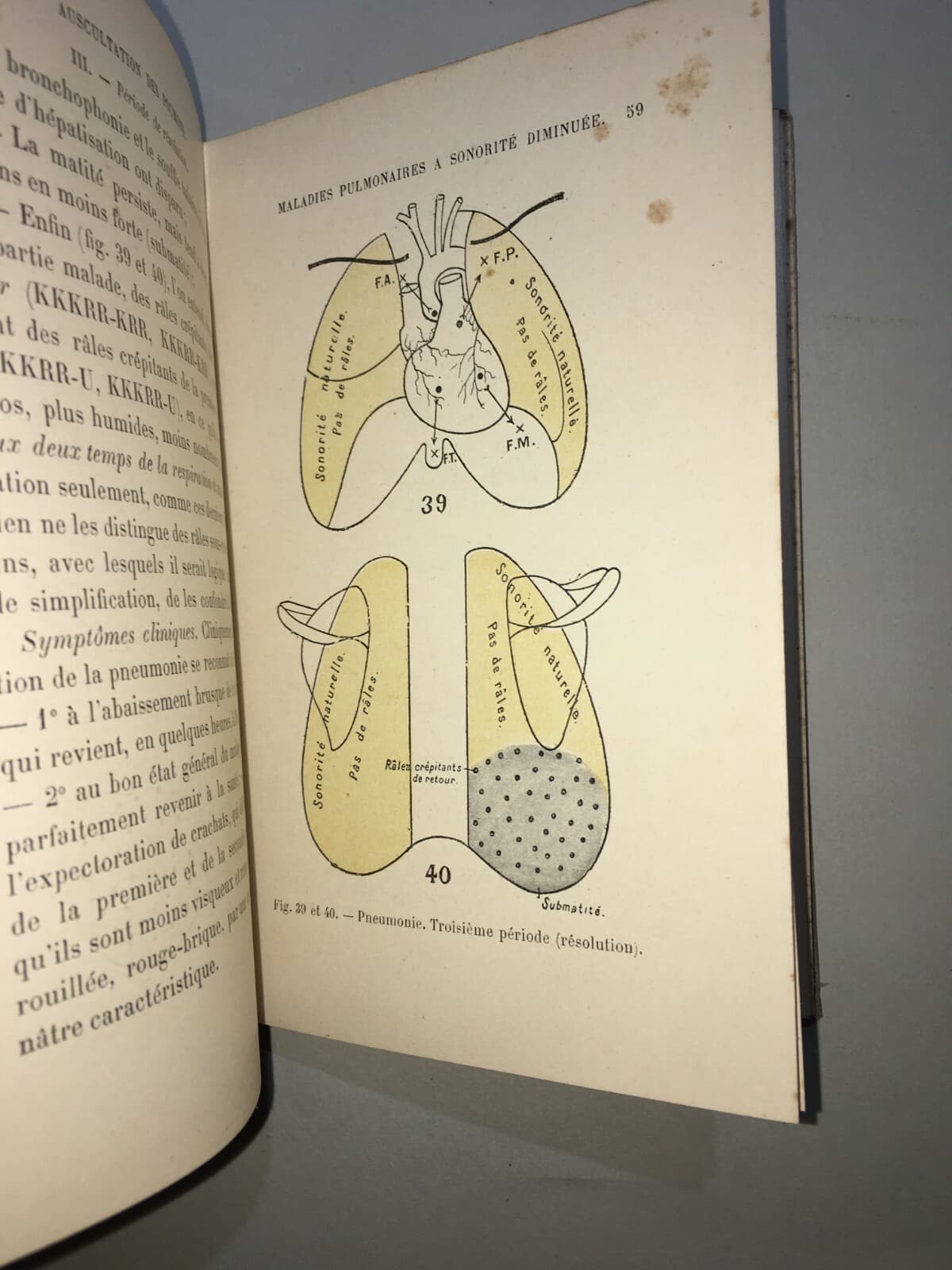 Medicina: Cardiologia, Ascoltazione Del Cuore E Pneumologia. Dr. Coiffier, 1897