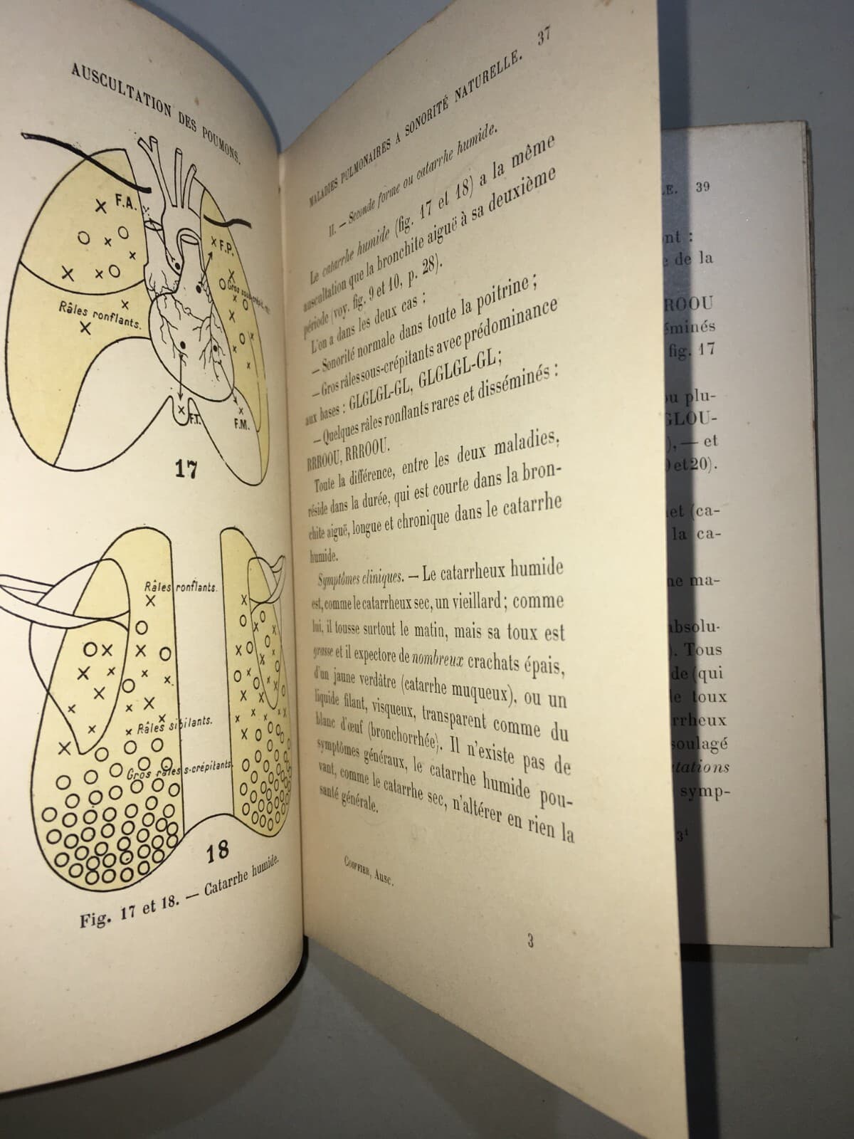 Medicina: Cardiologia, Ascoltazione Del Cuore E Pneumologia. Dr. Coiffier, 1897