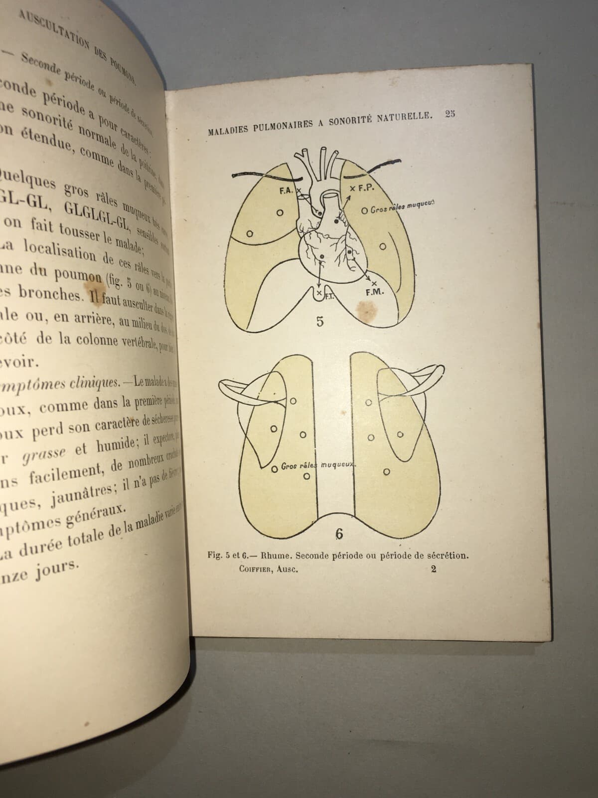 Medicina: Cardiologia, Ascoltazione Del Cuore E Pneumologia. Dr. Coiffier, 1897