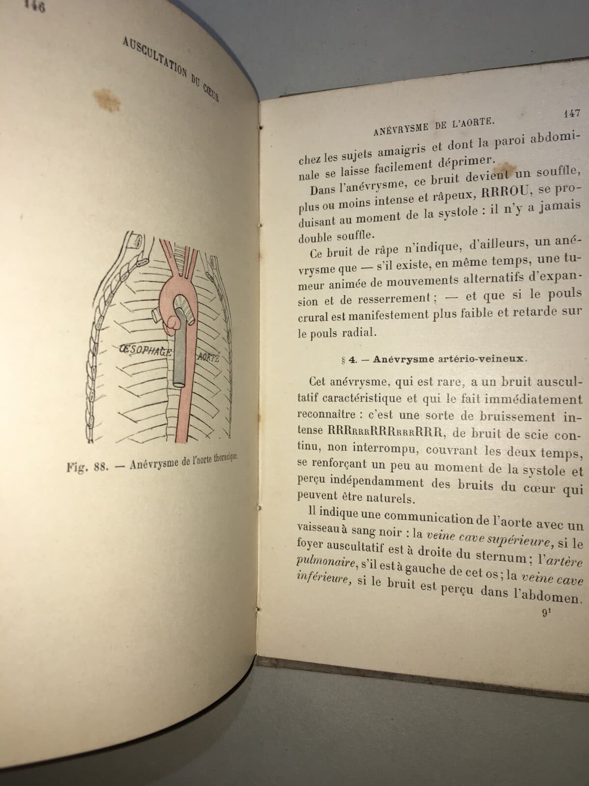 Medicina: Cardiologia, Ascoltazione Del Cuore E Pneumologia. Dr. Coiffier, 1897