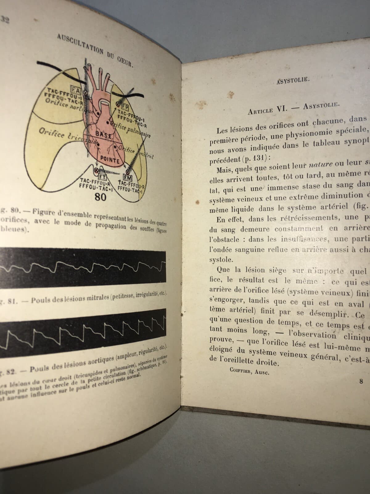 Medicina: Cardiologia, Ascoltazione Del Cuore E Pneumologia. Dr. Coiffier, 1897