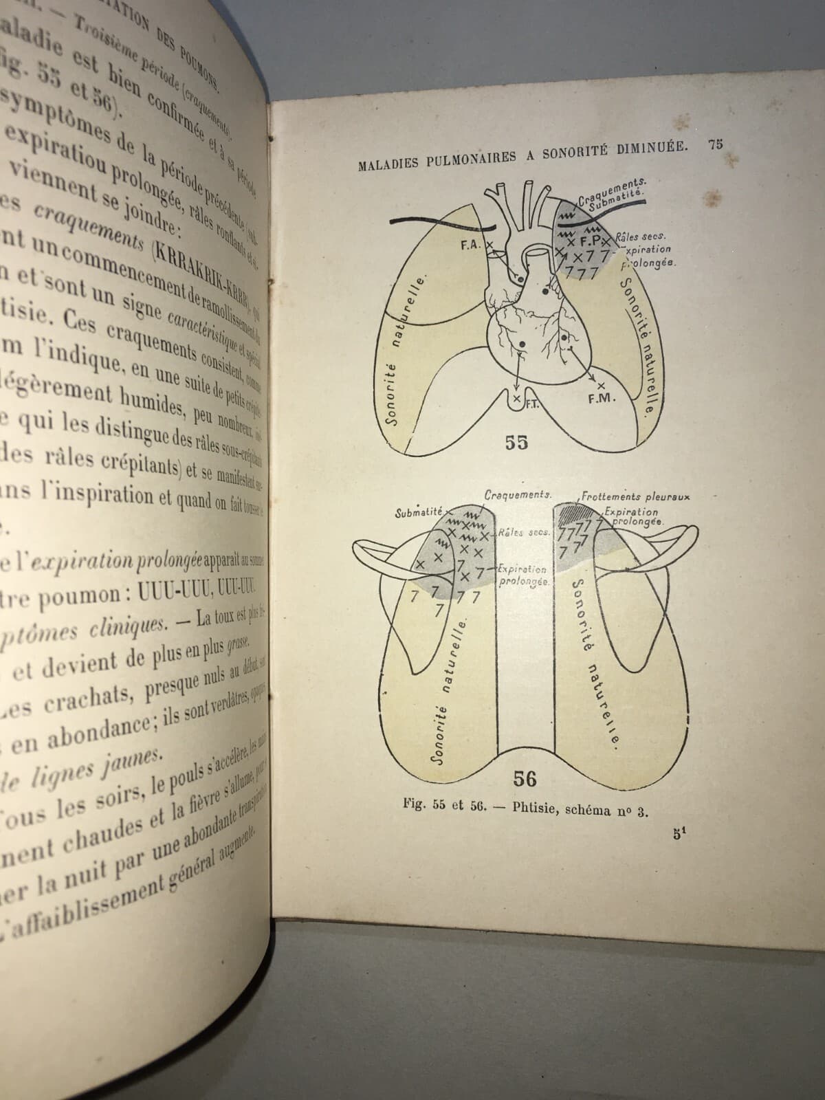 Medicina: Cardiologia, Ascoltazione Del Cuore E Pneumologia. Dr. Coiffier, 1897