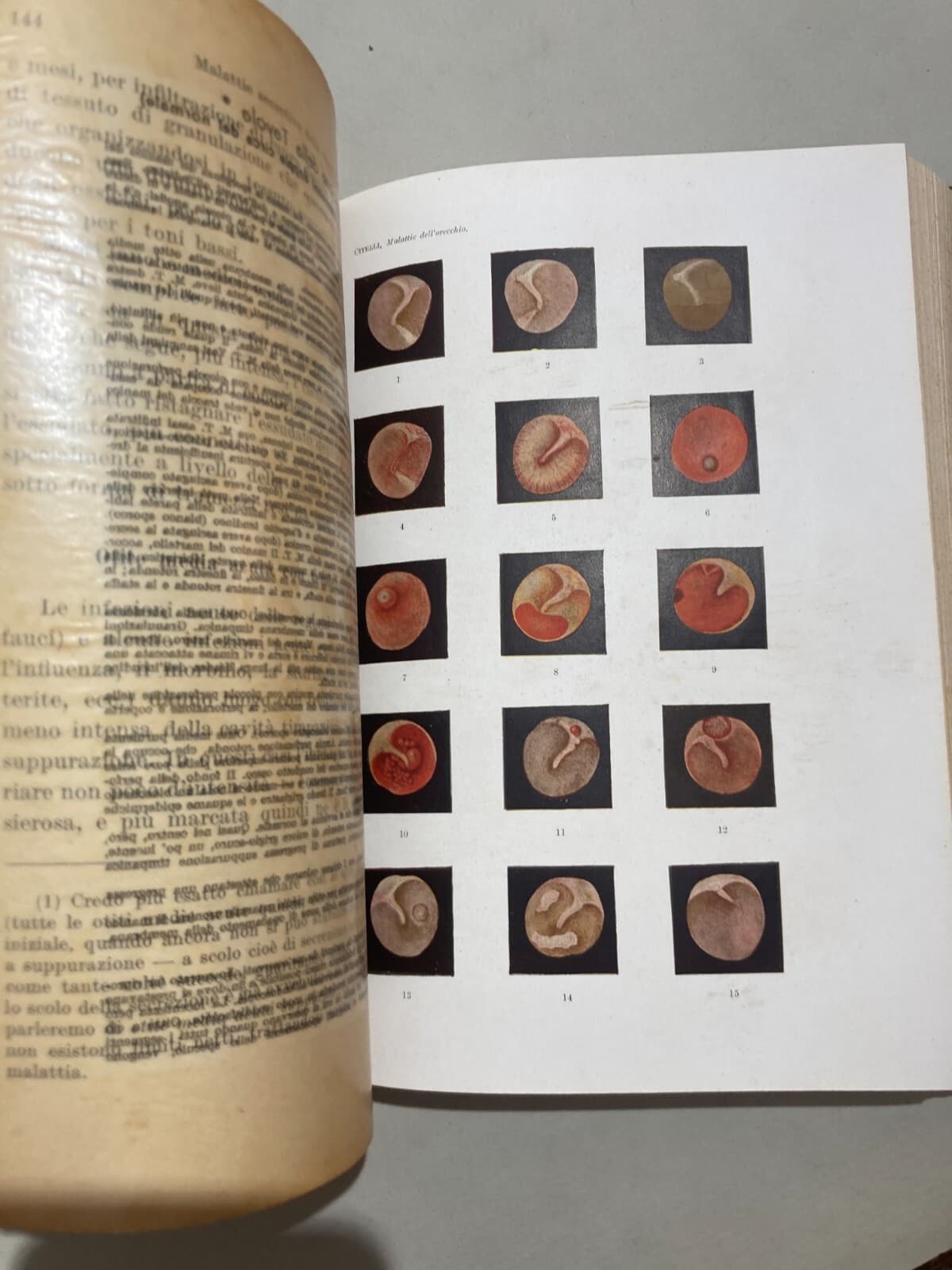 Medicina: Malattie Dell'Orecchio Di Salvatore Citelli, 1948