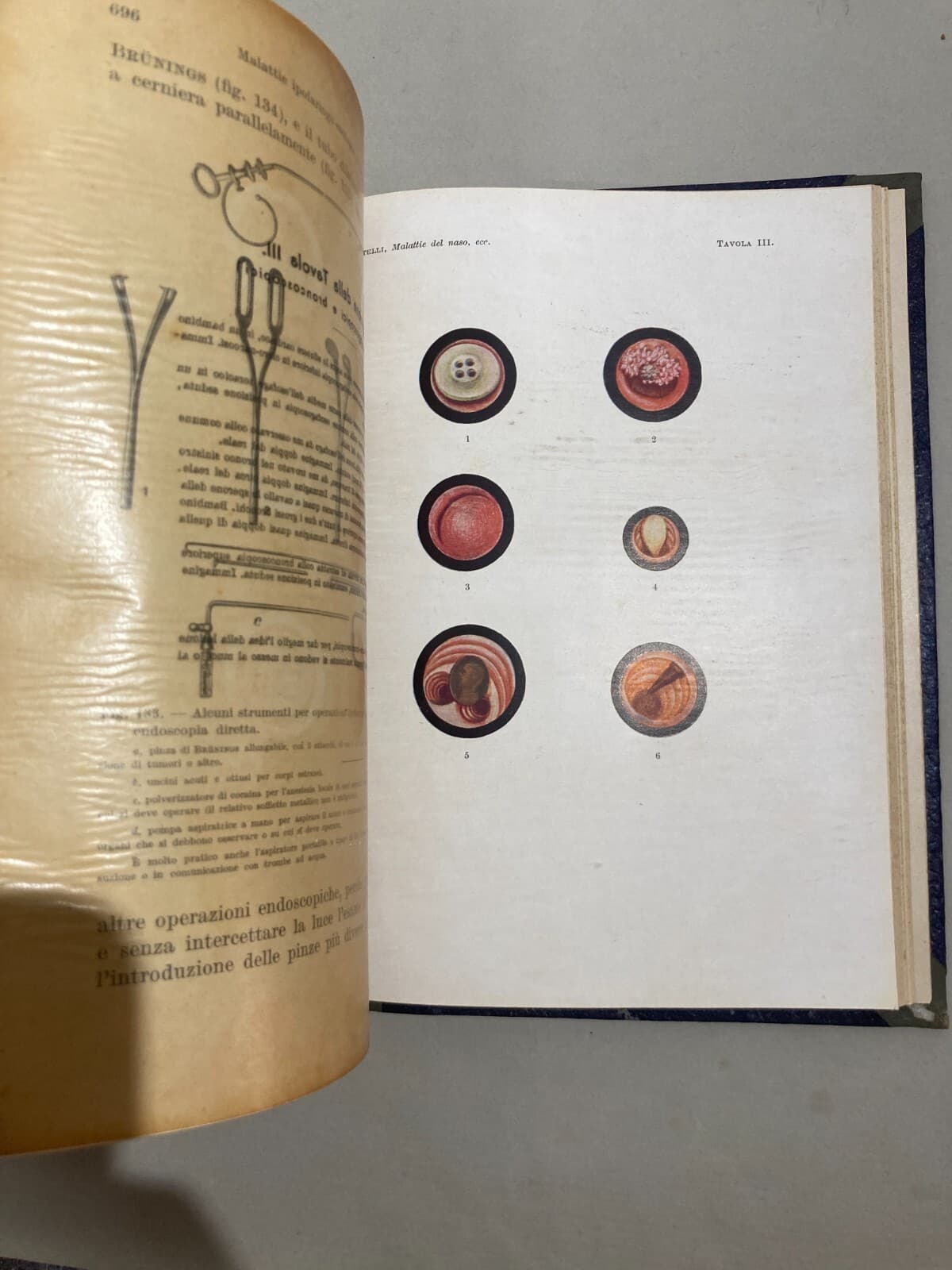 Medicina: Malattie Del Naso E Della Gola (1948)