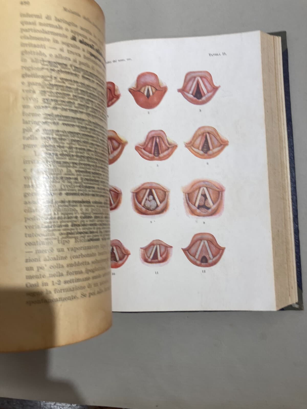 Medicina: Malattie Del Naso E Della Gola (1948)