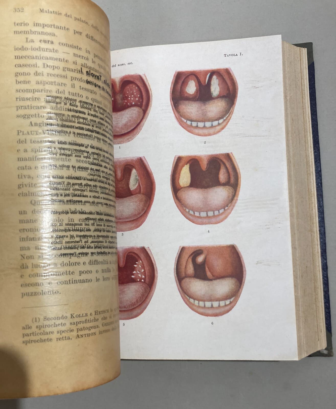 Medicina: Malattie Del Naso E Della Gola (1948)