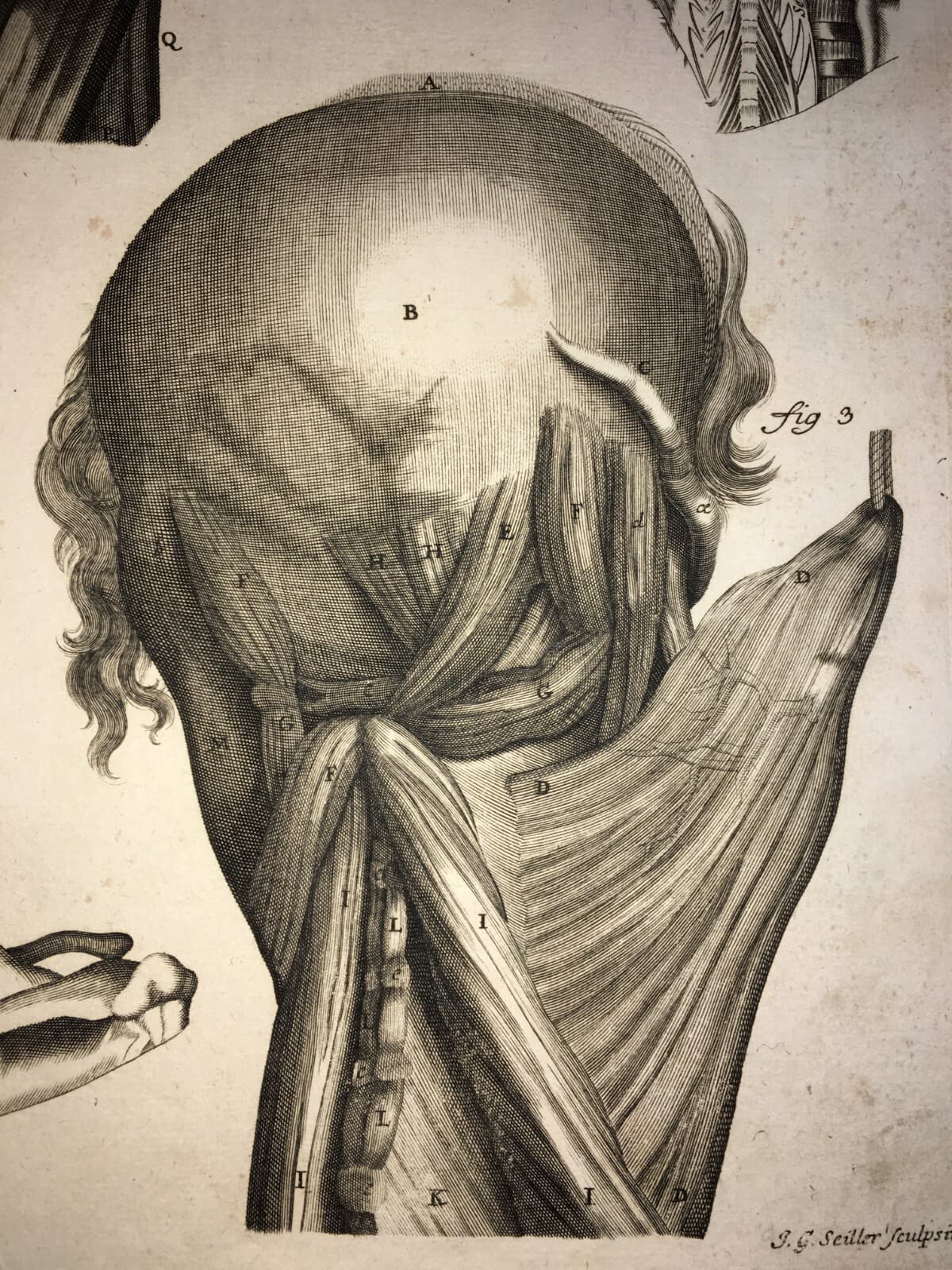 Medicina, Anatomia Umana: Muscolatura Di Testa E Collo. Artista Seiller, XVIII Secolo