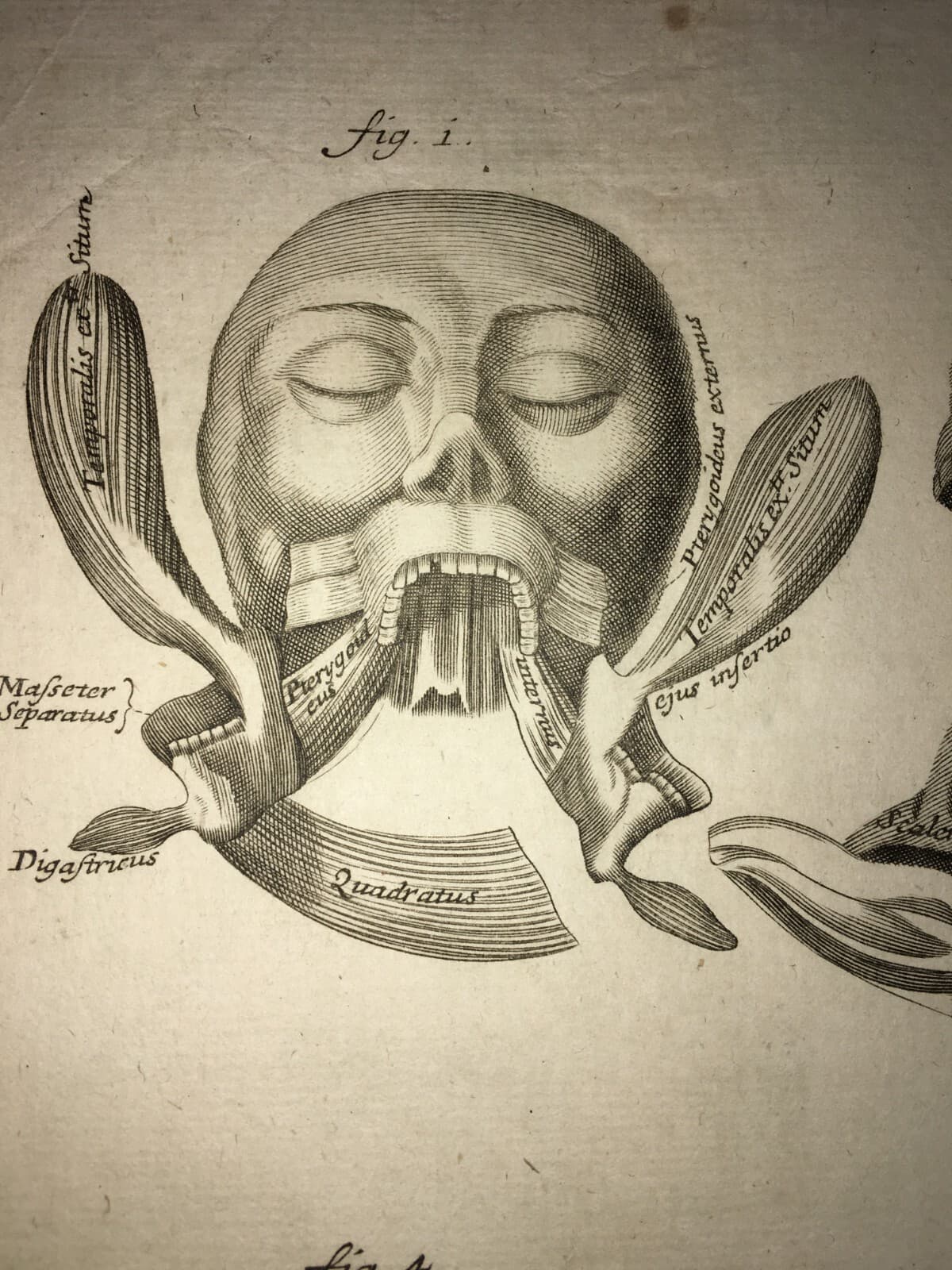 Medicina: Anatomia Umana. Muscolatura Di Collo E Tronco. Artista: Seiller. Incisione