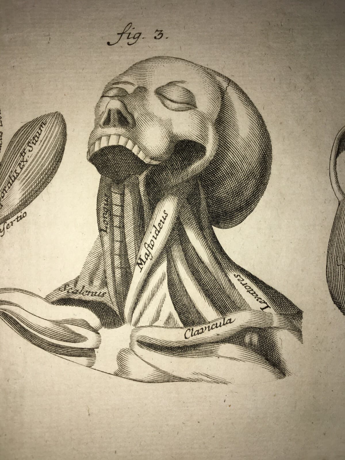 Medicina: Anatomia Umana. Muscolatura Di Collo E Tronco. Artista: Seiller. Incisione