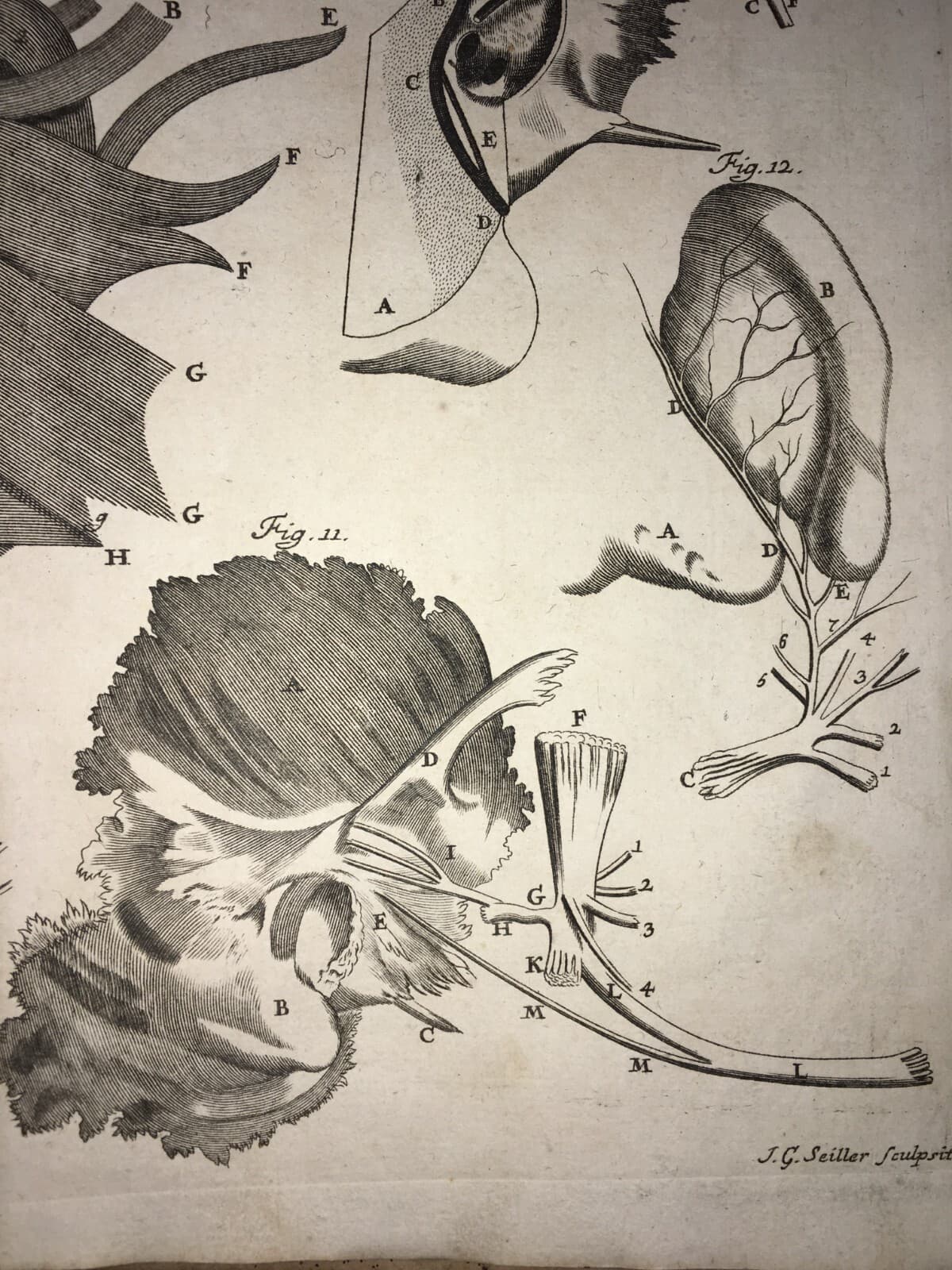 Medicina: Anatomia Umana, Organi Della Gola E Del Collo. Incisione Di Seiller, XVIII Secolo.