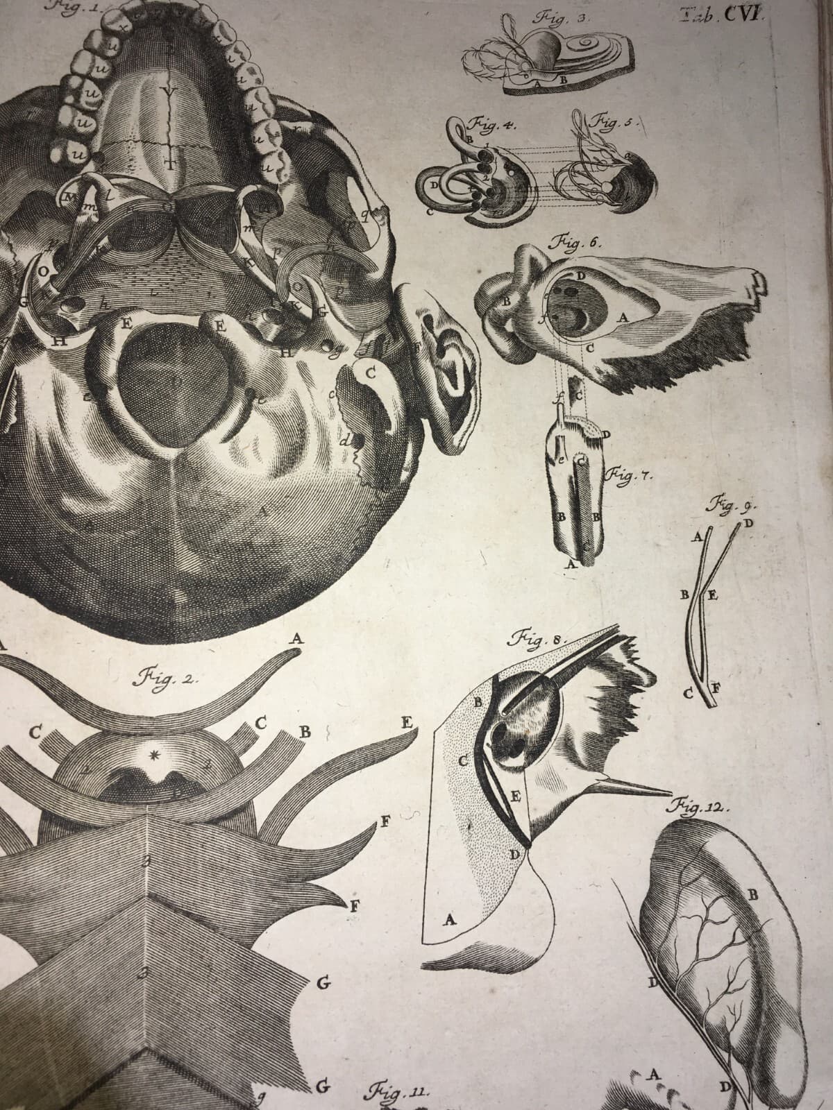 Medicina: Anatomia Umana, Organi Della Gola E Del Collo. Incisione Di Seiller, XVIII Secolo.