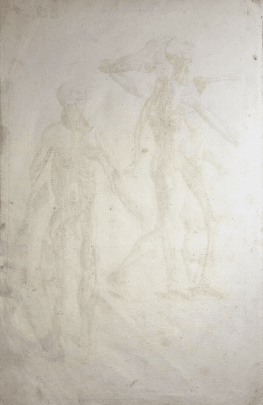 Medicina: Anatomia Umana, Apparato Muscolare Anteriore E Laterale   Seiller   XVIII Secolo