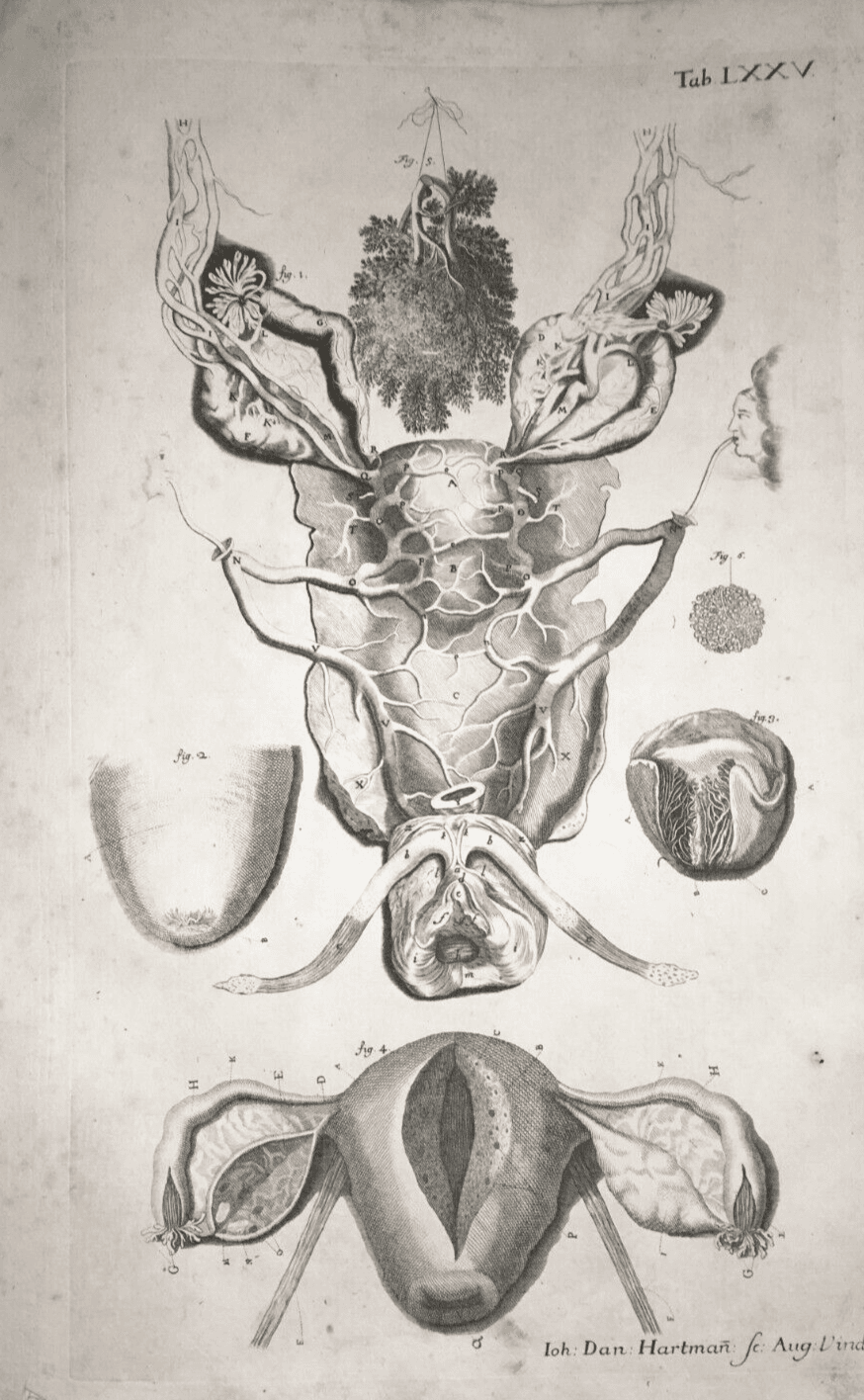 Medicina: Anatomia Umana E Ginecologia. Antica Incisione Di I.D. Hartman, XVIII Secolo.