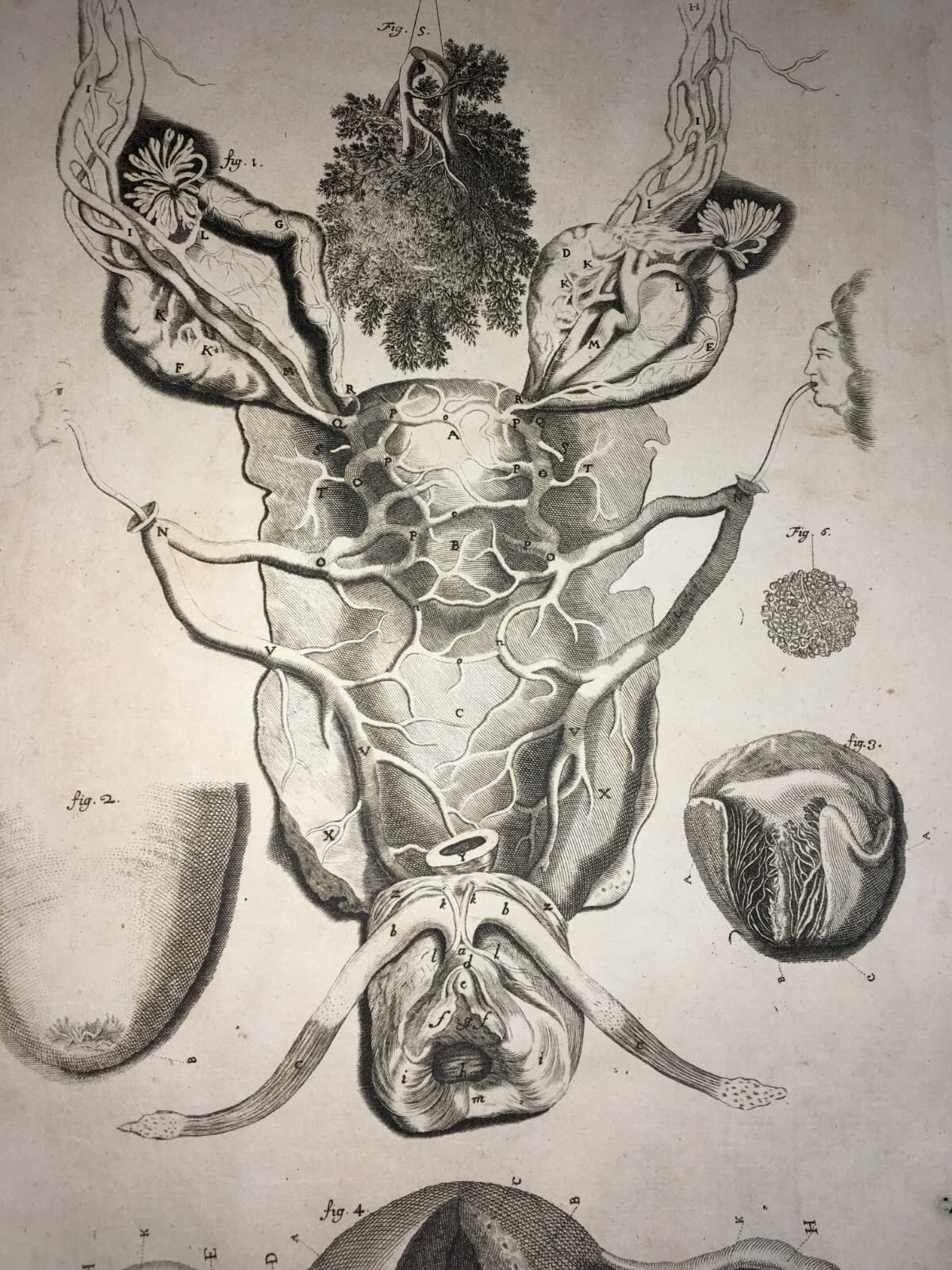 Medicina: Anatomia Umana E Ginecologia. Antica Incisione Di I.D. Hartman, XVIII Secolo.