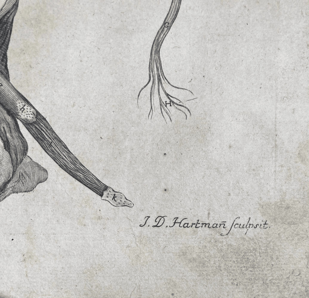 Medicina: Anatomia Umana, Ginecologia, Utero E Ovaie. Incisione Di Hartman, XVIII Secolo