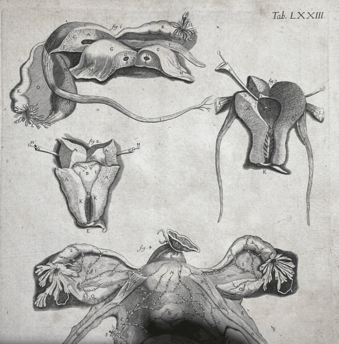 Medicina: Anatomia Umana, Ginecologia, Utero E Ovaie. Incisione Di Hartman, XVIII Secolo