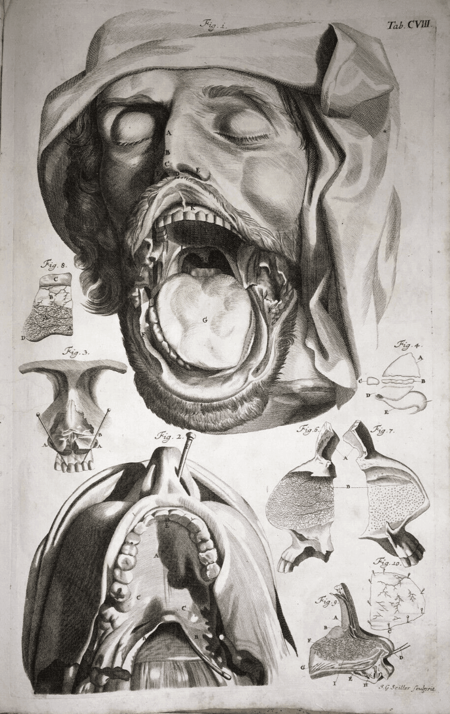 Medicina, Anatomia: Apparato Della Bocca, Lingua, Denti, Naso. Rara Incisione Di Seiller