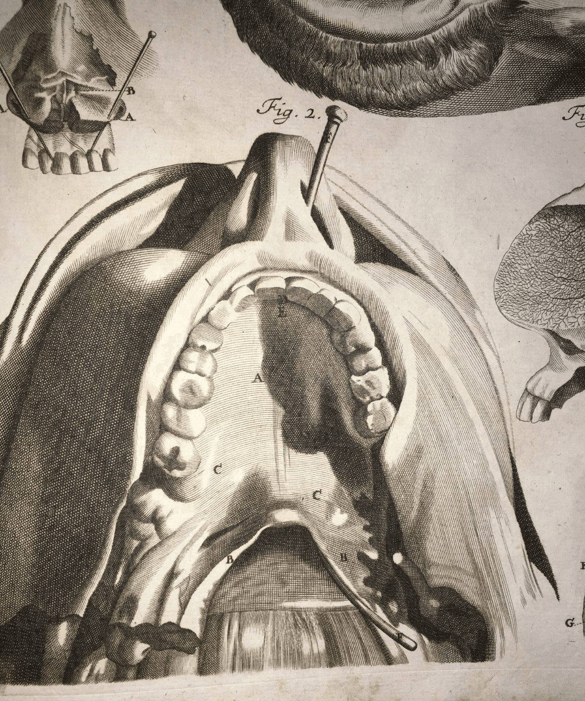 Medicina, Anatomia: Apparato Della Bocca, Lingua, Denti, Naso. Rara Incisione Di Seiller