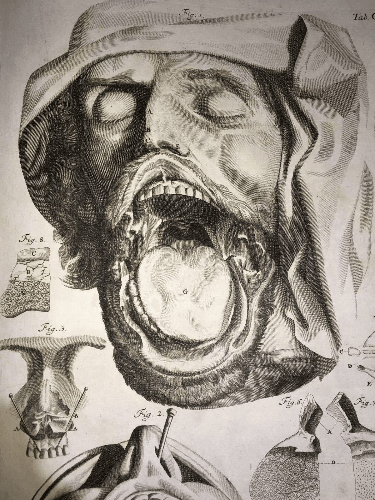 Medicina, Anatomia: Apparato Della Bocca, Lingua, Denti, Naso. Rara Incisione Di Seiller