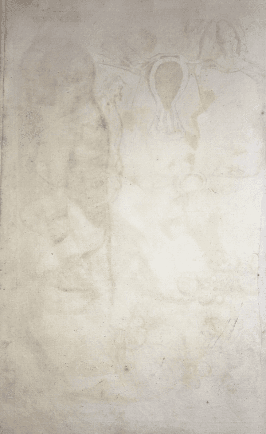 Medicina, Pediatria, Ostetricia, Ginecologia: Incisione Antica Di Feto, Hartmann, XVIII Secolo.