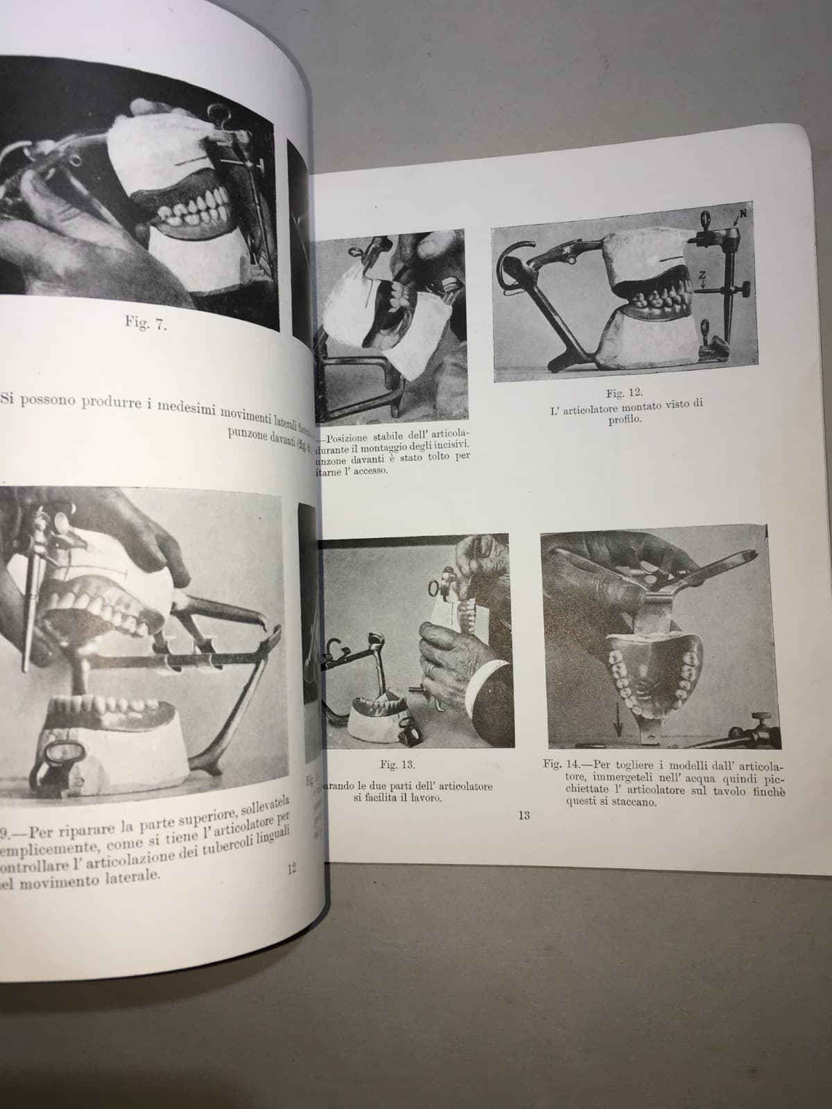 Montaggio Di Apparecchi Con Denti Anatoform E Blocchi Gysi. Metodo Del Dr. Gysi (Anni '30)