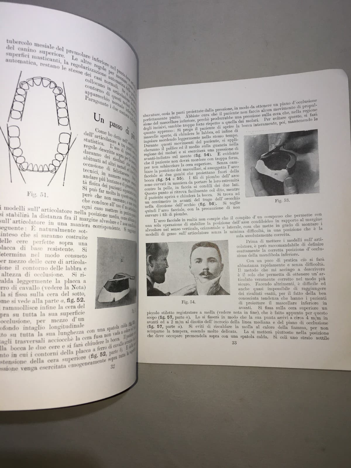 Montaggio Di Apparecchi Con Denti Anatoform E Blocchi Gysi. Metodo Del Dr. Gysi (Anni '30)