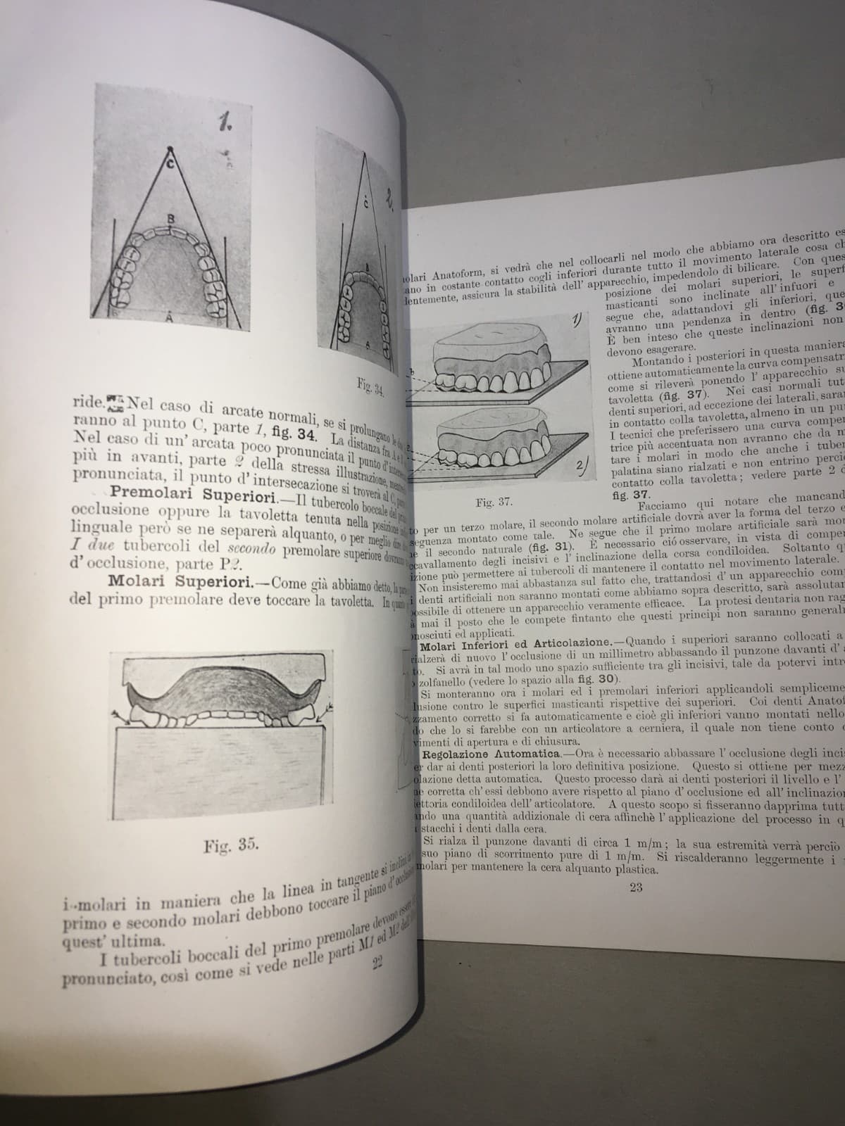 Montaggio Di Apparecchi Con Denti Anatoform E Blocchi Gysi. Metodo Del Dr. Gysi (Anni '30)
