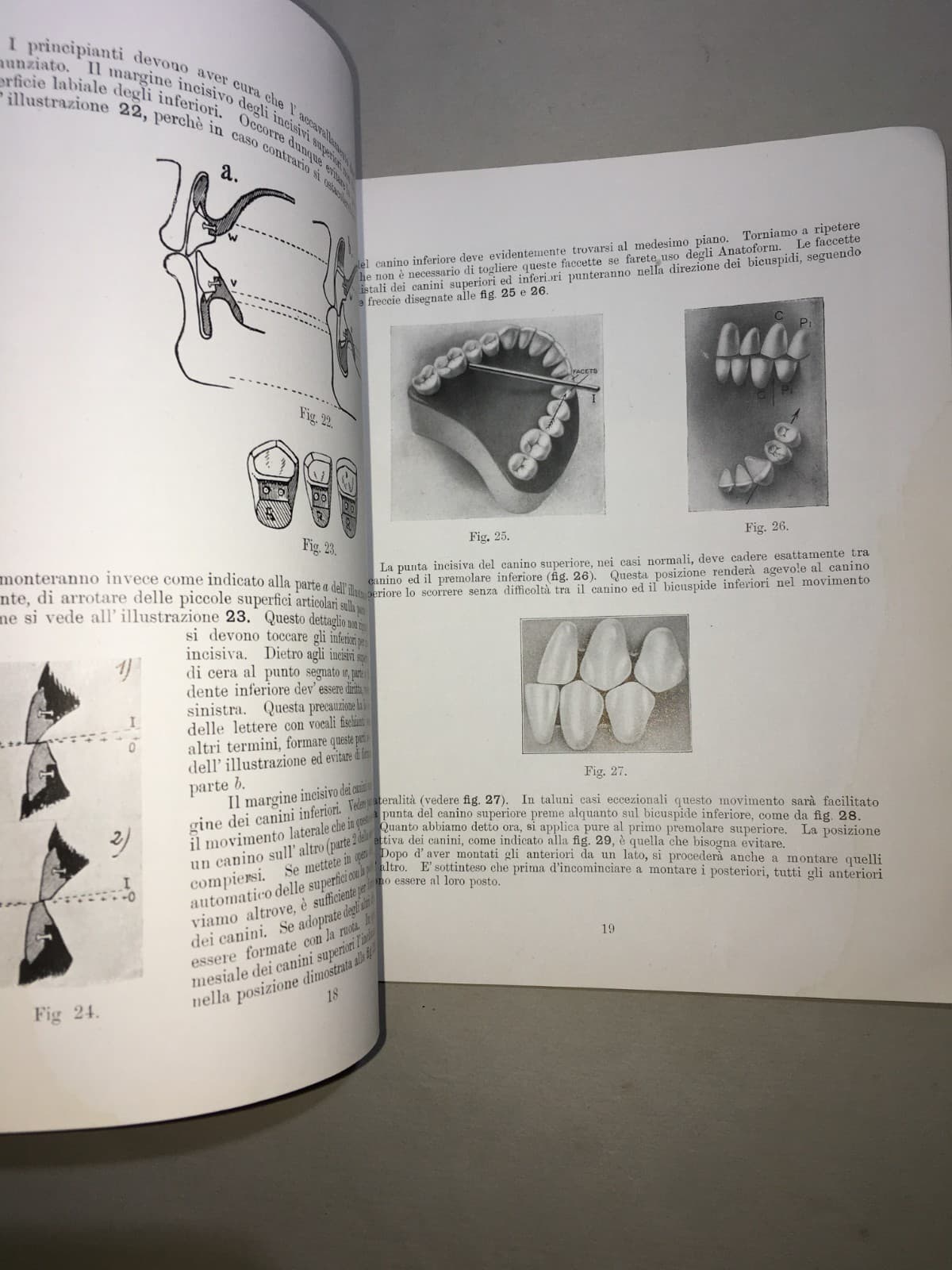 Montaggio Di Apparecchi Con Denti Anatoform E Blocchi Gysi. Metodo Del Dr. Gysi (Anni '30)