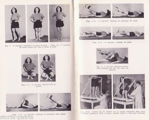 Varici E Sindromi Venose Delle Gambe   A. Warter (1955)