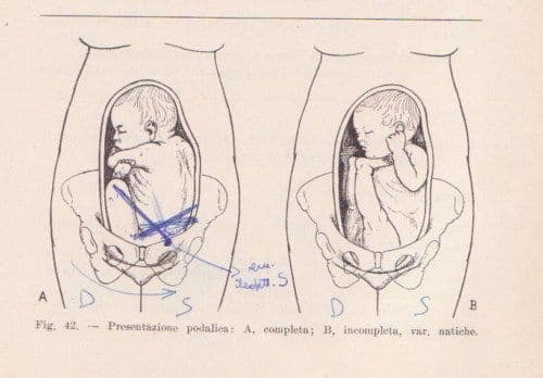 Manuale Pratico Di Ostetricia E Ginecologia   Mario Nizza (1956)