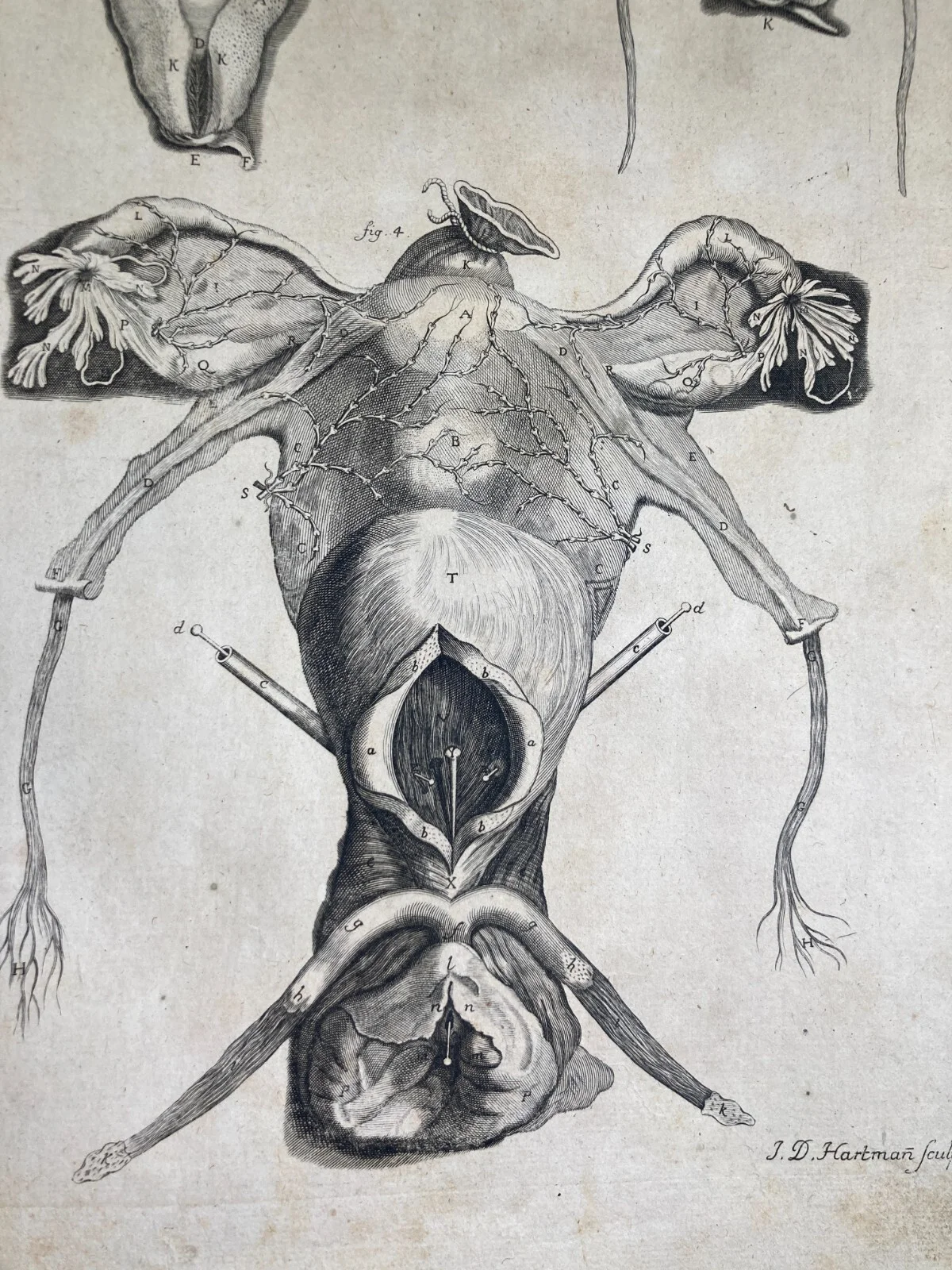 Medicina: Anatomia Umana, Ginecologia, Utero E Ovaie. Incisione Di Hartman, XVIII Secolo, foto 5 di 6