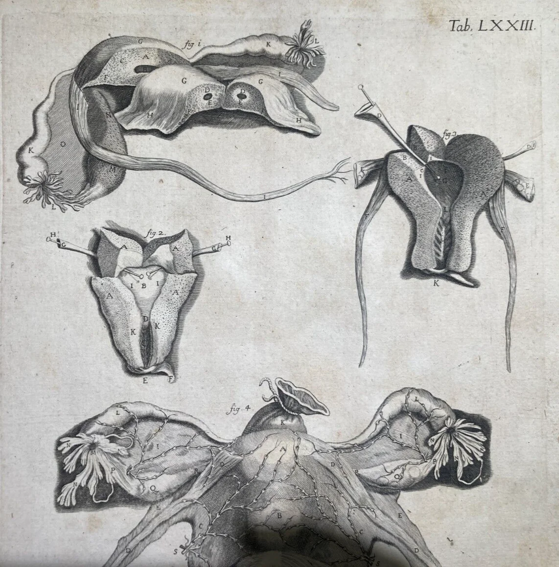 Medicina: Anatomia Umana, Ginecologia, Utero E Ovaie. Incisione Di Hartman, XVIII Secolo, foto 3 di 6