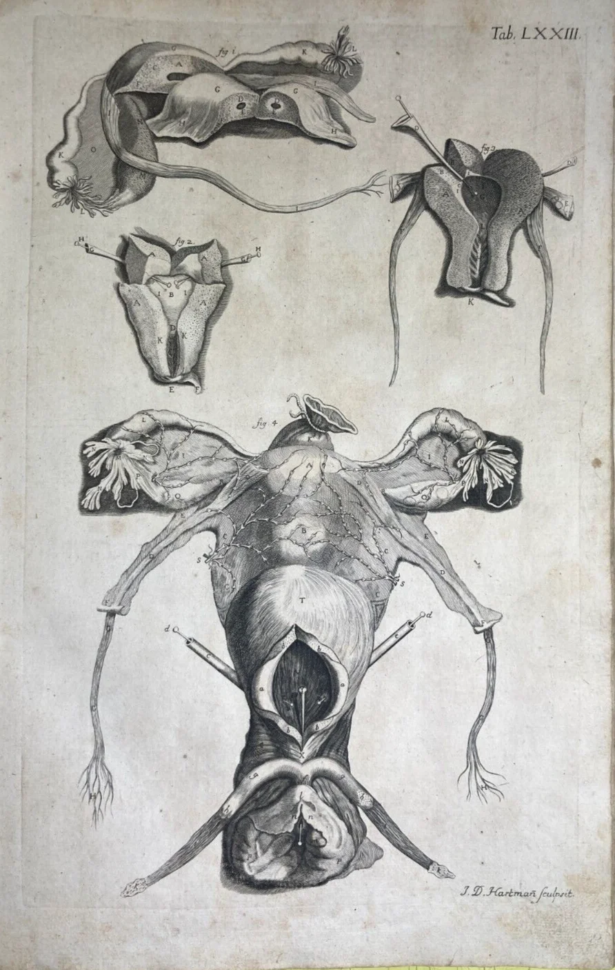 Medicina: Anatomia Umana, Ginecologia, Utero E Ovaie. Incisione Di Hartman, XVIII Secolo, foto 2 di 6