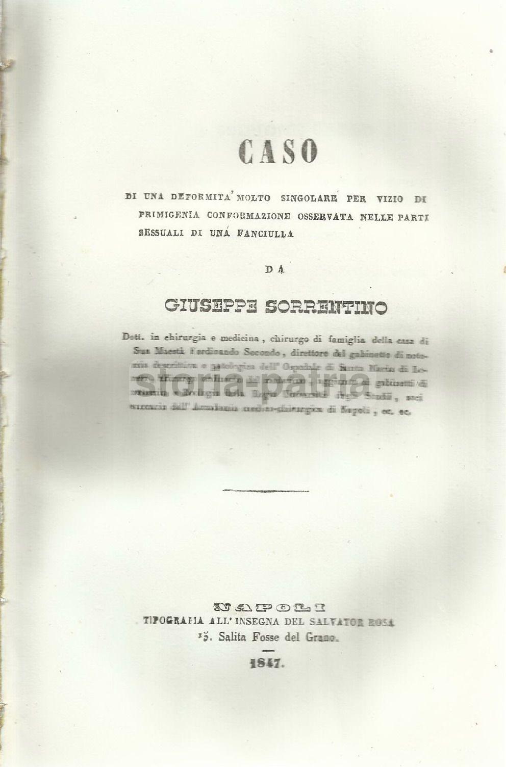 Medicina, Ginecologia, Chirurgia, Anatomia Patologica, Rara Deformazione, Napoli, 1847 immagine 1