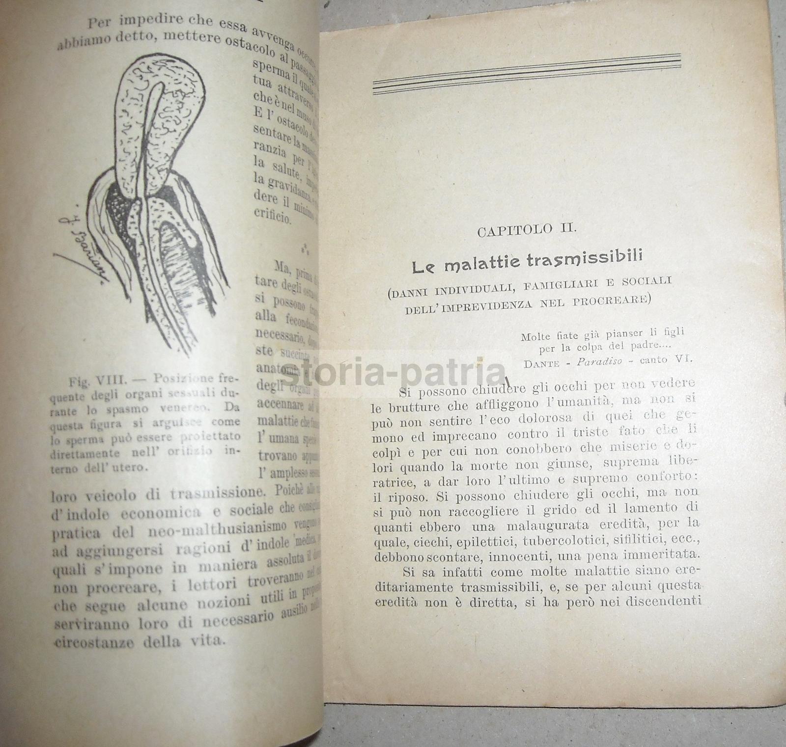 Medicina, Ginecologia, Contraccezione, Anticoncezionali, Preservativi, Belloni, Giorni immagine 6