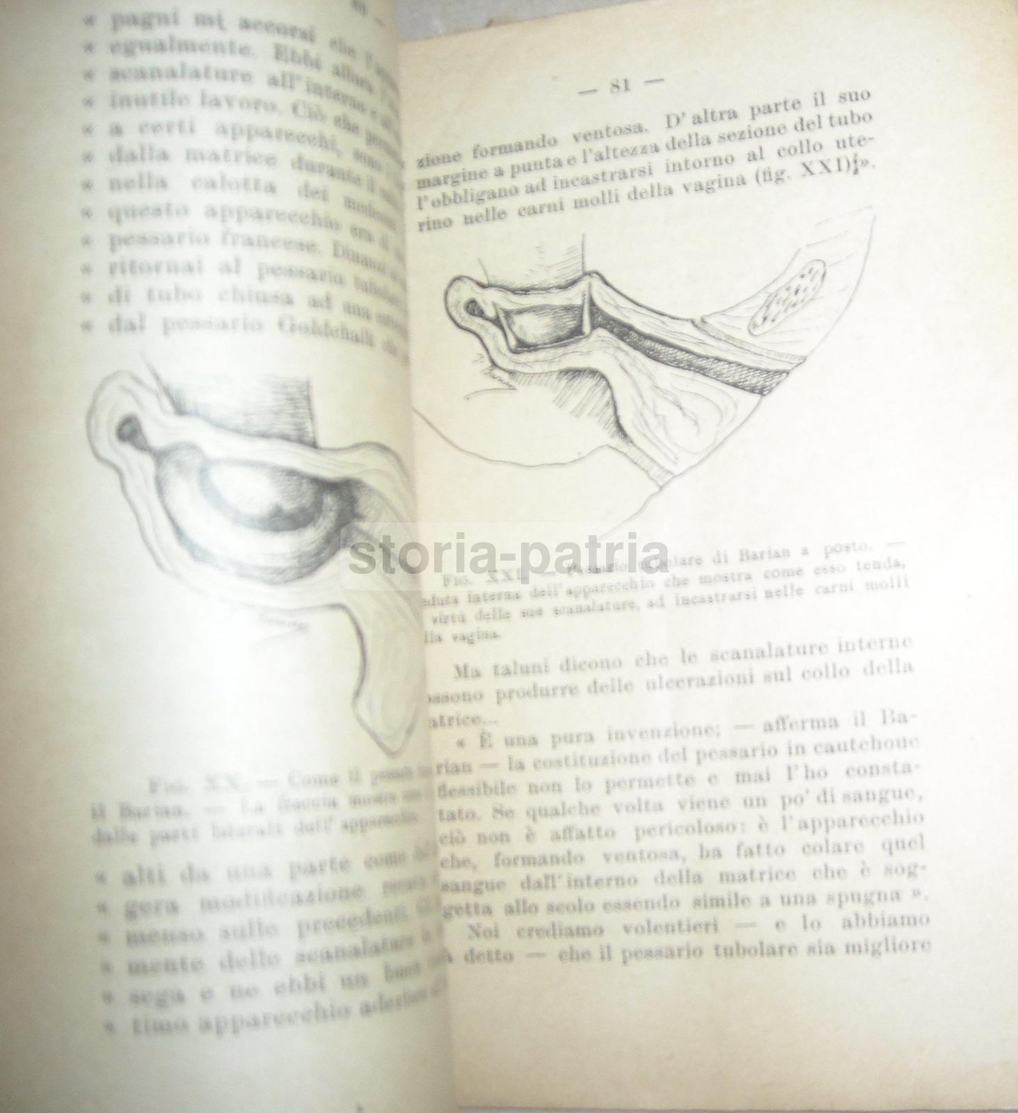 Medicina, Ginecologia, Contraccezione, Anticoncezionali, Preservativi, Belloni, Giorni immagine 8