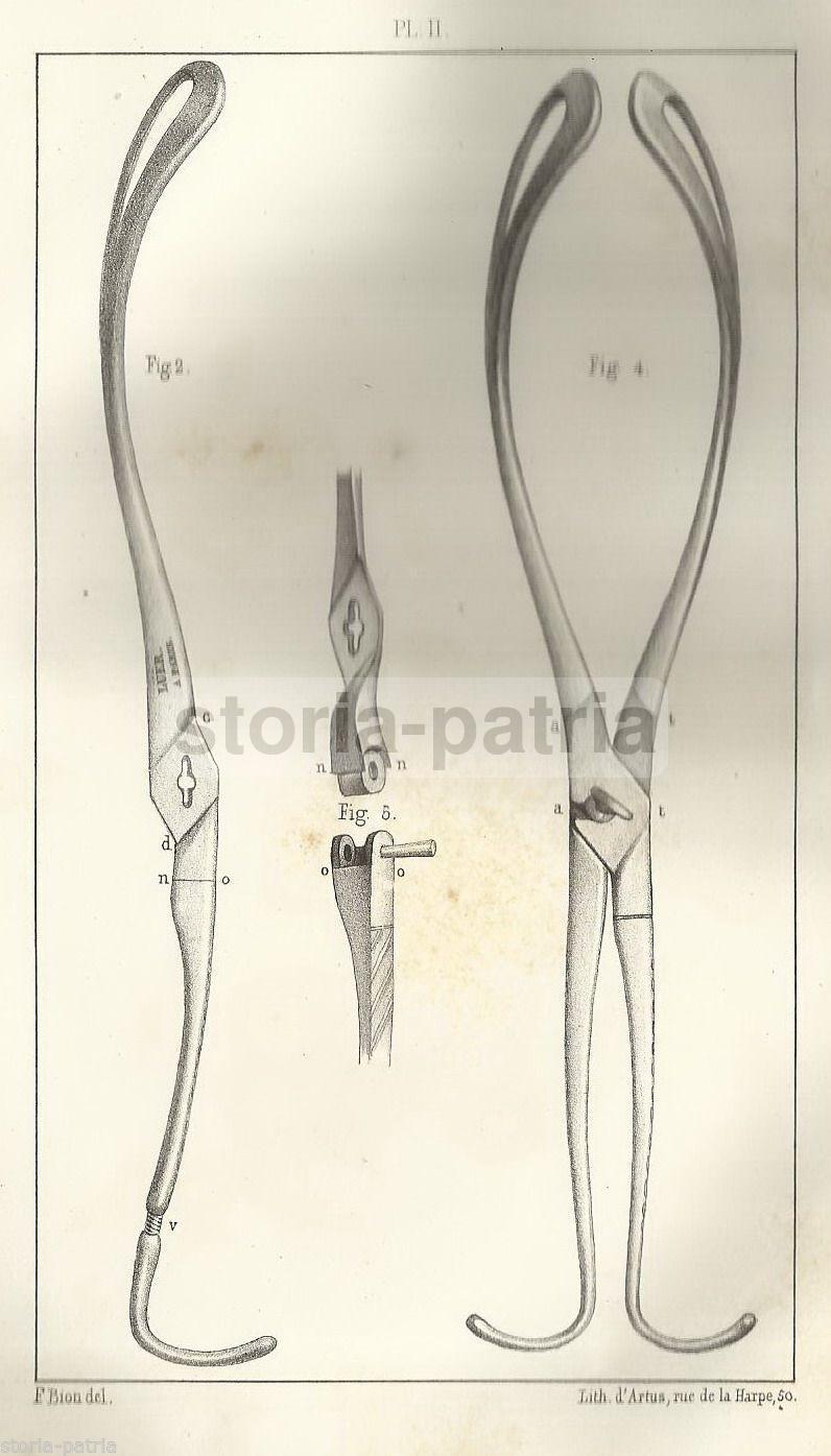 Medicina, Ginecologia, Ostetricia, Strumenti, Forcipe Tarsitani, Duca Serracapriola immagine 1